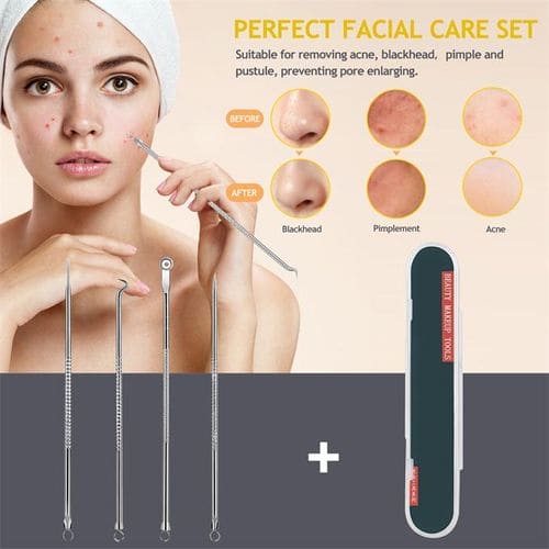 Set Of 4 Pimple Popper Needle, 4-In-1 Multifunctional Acne Needles, Blackhead Remover Tools, Spoon Face Skin Care Tools, Steel Blackhead Removal Kit, Women Beauty Acne Treatment Pore Cleanser Needle Hook, Comedone Extractor Remover Set for All Skin Types Set Of 4 Pimple Popper Needle, 4-In-1 Multifunctional Acne Needles, Blackhead Remover Tools, Spoon Face Skin Care Tools, Steel Blackhead Removal Kit, Women Beauty Acne Treatment Pore Cleanser Needle Hook, Comedone Extractor Remover Set for All Skin Types